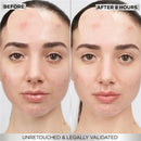 Garnier Pure Active Pimple Patch Invisible x8 Patches