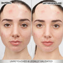 Before-and-after split comparison of a woman's face showing skin improvement after 8 hours, with 'BEFORE' on the left and 'AFTER 8 HOURS' on the right.