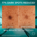 6x L'Oreal Paris Revitalift Bright Reveal Serum 30ml